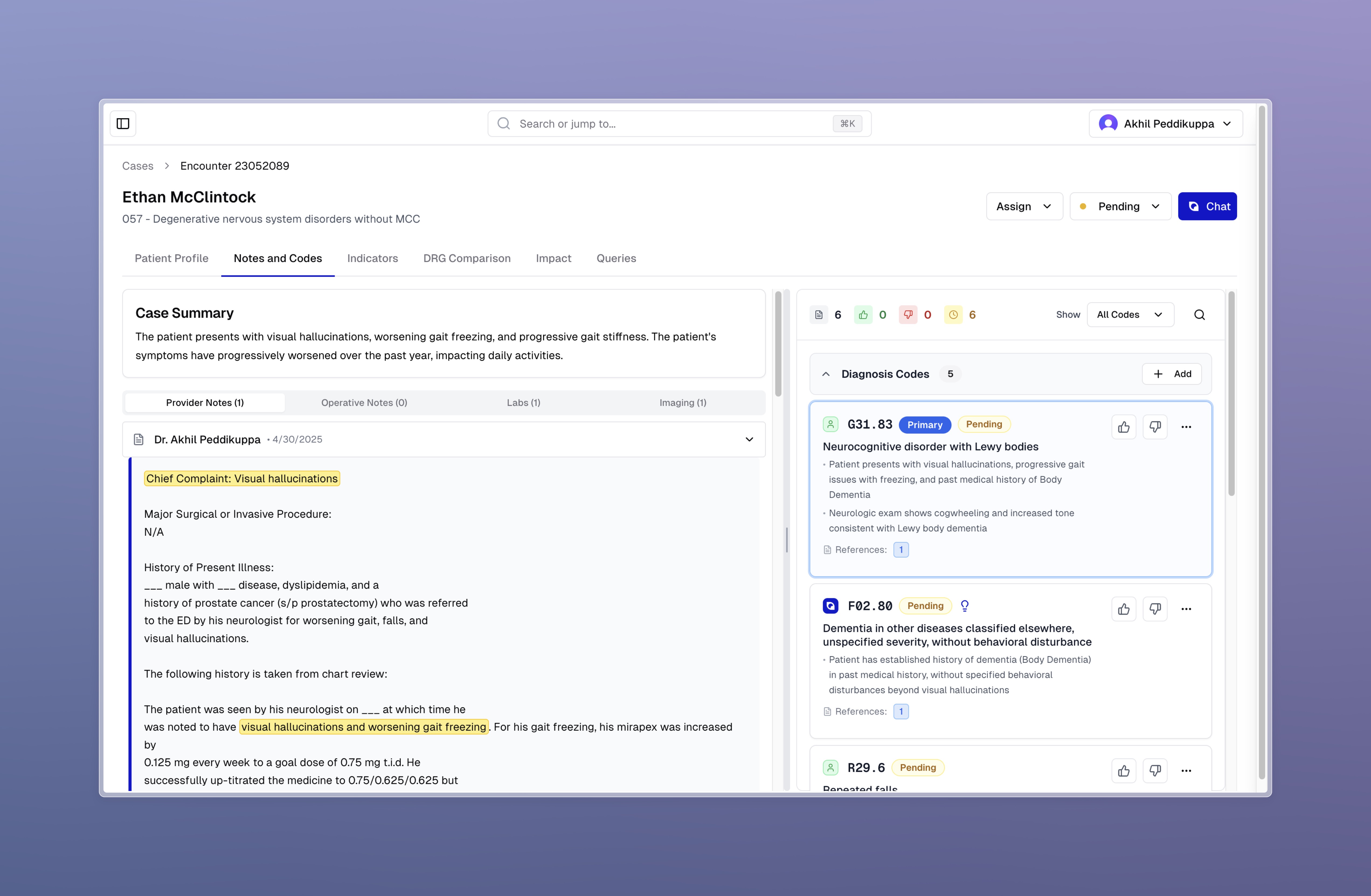 HorusCDI Interface
